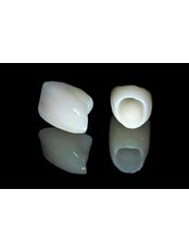Porcelain Crown - Dr.Tamer Z. Thabet Dental Clinic