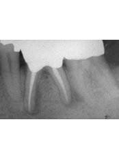 Dental X-Ray - Dr.Tamer Z. Thabet Dental Clinic