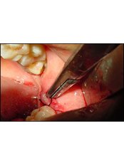 Oral and Maxillofacial Surgeon Consultation - Dr.Tamer Z. Thabet Dental Clinic