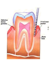 Periodontist Consultation - Dr.Tamer Z. Thabet Dental Clinic