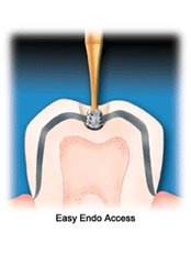 Endodontist Consultation - Dr.Tamer Z. Thabet Dental Clinic