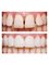 Elite Dental and Medical Center - Maadi - smile make over and correction 