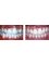 Elite Dental and Medical Center - Maadi - before and after ortho 