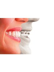 Braces - Sheraton Dental Clinic