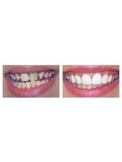 Cosmetic Dentist Consultation - Golf Dental Care
