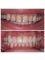 Dr. Moustafa Nashat - E-Max Veneers to enhance smile and color 