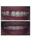 Smile Care Dental Clinic - Replacing Missing tooth by fixed resoration 