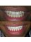 Smile Care Dental Clinic - Laser Whitening 