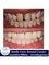 Smile Care Dental Clinic - Cosmetic treatment by E-max resorations 