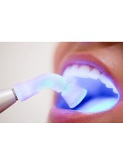 Teeth Whitening - Highdent Center