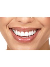 Teeth Whitening - Lorenzana Dental Center