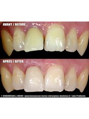Dentist Consultation - Bensoussan & Lucien dentists Antibes