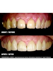 Dentist Consultation - Bensoussan & Lucien dentists Antibes