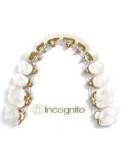 Incognito™ Braces - Center Of Dental Expertise in Melissia