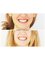 Center Of Dental Expertise in Melissia - Lingual braces smile! 