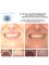 Center Of Dental Expertise - Lofou 4A - Ekali 14578, Athens,  32