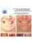 Center Of Dental Expertise - Lofou 4A - Ekali 14578, Athens,  26