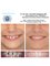 Center Of Dental Expertise - Lofou 4A - Ekali 14578, Athens,  19