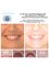 Center Of Dental Expertise - Lofou 4A - Ekali 14578, Athens,  33