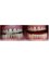 Dent Artistry Contemporary Prosthodontics - Before and after-porcelain veneers 