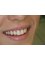 Dental Aesthetics Athens - Digital Smile Design 