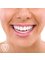 Dental Aesthetics Athens - Our assignment : Ideal smile design 