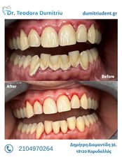 Teeth Cleaning - Dr. Teodora Dumitriu