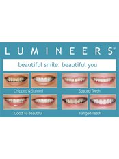 Lumineers™ - Skourasdent Clinic