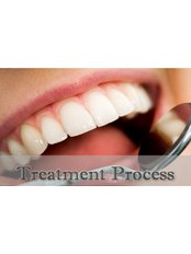 Periodontitis Treatment - Skourasdent Clinic