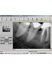 Digital Dental X-Ray - Skourasdent Clinic
