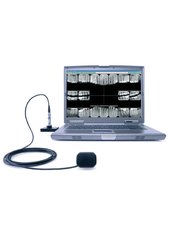 Digital Dental X-Ray - Skourasdent Clinic