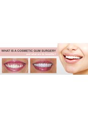 Gum Surgery - Skourasdent Clinic