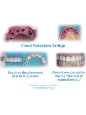 Porcelain Bridge - Skourasdent Clinic