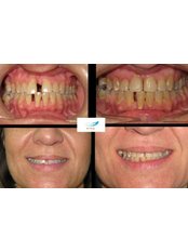Orthodontics - ismile.gr