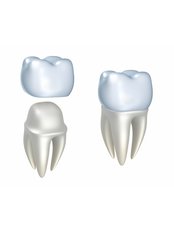 Dental Crowns - Gentle Dental Clinic - Crete