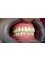 Lyro Dental Clinic Single Member P.C. - Therissou 122, Heraklion, Crete, 71304,  22