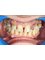 Your Smile Dental Care - before treatment 