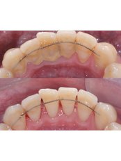 Orthodontics - Especialistas Dentales Internacional/ Dental Specialist International