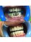Hungary Dental Implant - Budapest - Dental implant treatment_before-after3 