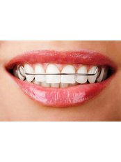 Orthodontic Retainer - Relax Dental Spa