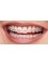 Smile Expedia - Orthodontic Treatment 