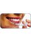 Agravat Dental Tourism & Medical Tourism - clear-ortho-braces-offers-ahmedabad-india 