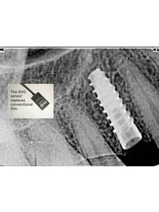 Dentist Consultation - Ivories Dental Clinic & Dental Implant Clinic