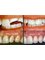 Ivories Dental Clinic & Dental Implant Clinic - esthetic dental treatments 