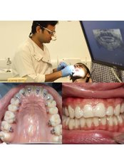 Dentist Consultation - Planet Dental Clinic