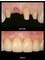 Jain Dental Hospital and Oral Health Care Centre -  teeth implant 