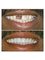 Jain Dental Hospital and Oral Health Care Centre - fix teeths 