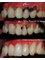 Jain Dental Hospital and Oral Health Care Centre - teeth fillings compare 