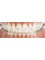 Jain Dental Hospital and Oral Health Care Centre - ceramic  braces 