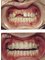Jain Dental Hospital and Oral Health Care Centre - fix teeth before and after 